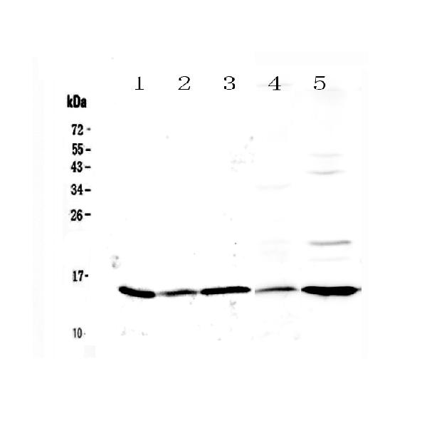 Western blot analysis of Galectin 1 using anti-Galectin 1 antibody (A00470-1). Electrophoresis was performed on a 5-20% SDS-PAGE gel at 70V (Stacking gel) / 90V (Resolving gel) for 2-3 hours. The sample well of each lane was loaded with 50ug of sample under reducing conditions. Lane 1: rat gaster tissue lysates, Lane 2: rat ovary tissue lysates, Lane 3: rat testis tissue lysates, Lane 4: mouse kidney tissue lysates, Lane 5: human Hela whole cell lysates. After Electrophoresis, proteins were transferred to a Nitrocellulose membrane at 150mA for 50-90 minutes. Blocked the membrane with 5% Non-fat Milk/ TBS for 1.5 hour at RT. The membrane was incubated with rabbit anti-Galectin 1 antigen affinity purified polyclonal antibody (Catalog # A00470-1) at 0.5 ug/mL overnight at 4 then washed with TBS-0.1%Tween 3 times with 5 minutes each and probed with a goat anti-rabbit IgG-HRP secondary antibody at a dilution of 1:10000 for 1.5 hour at RT. The signal is developed using an Enhanced Chemiluminescent detection (ECL) kit (Catalog # EK1002) with Tanon 5200 system. A specific band was detected for Galectin 1 at approximately 15KD. The expected band size for Galectin 1 is at 15KD.