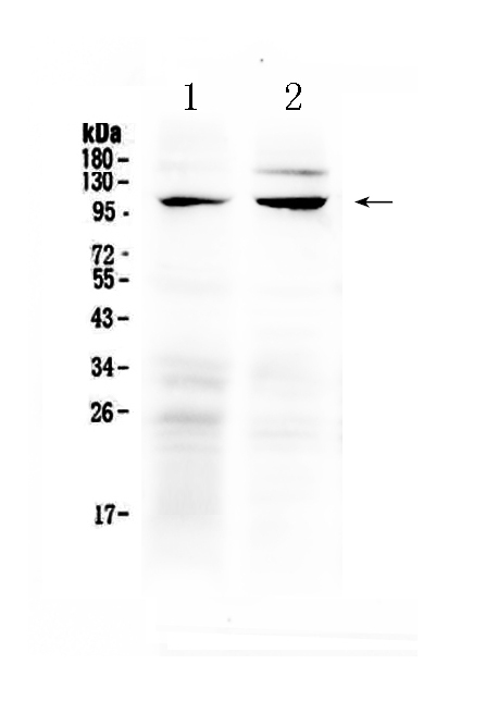 Western blot analysis of TRPC6 using anti-TRPC6 antibody (A00625).