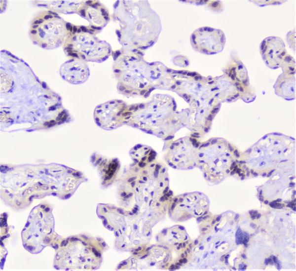 IHC analysis of CFP using anti-CFP antibody (A00852-2). CFP was detected in paraffin-embedded section of human placenta tissue. Heat mediated antigen retrieval was performed in citrate buffer (pH6, epitope retrieval solution) for 20 mins. The tissue section was blocked with 10% goat serum. The tissue section was then incubated with 1μg/ml rabbit anti-CFP Antibody (A00852-2) overnight at 4°C. Biotinylated goat anti-rabbit IgG was used as secondary antibody and incubated for 30 minutes at 37°C. The tissue section was developed using Strepavidin-Biotin-Complex (SABC)(Catalog # SA1022) with DAB as the chromogen.