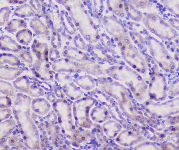 IHC analysis of CFP using anti-CFP antibody (A00852-2). CFP was detected in paraffin-embedded section of mouse kidney tissue. Heat mediated antigen retrieval was performed in citrate buffer (pH6, epitope retrieval solution) for 20 mins. The tissue section was blocked with 10% goat serum. The tissue section was then incubated with 1μg/ml rabbit anti-CFP Antibody (A00852-2) overnight at 4°C. Biotinylated goat anti-rabbit IgG was used as secondary antibody and incubated for 30 minutes at 37°C. The tissue section was developed using Strepavidin-Biotin-Complex (SABC)(Catalog # SA1022) with DAB as the chromogen.