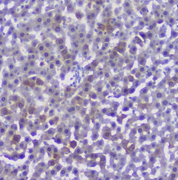 IHC analysis of CFP using anti-CFP antibody (A00852-2). CFP was detected in paraffin-embedded section of rat liver tissue. Heat mediated antigen retrieval was performed in citrate buffer (pH6, epitope retrieval solution) for 20 mins. The tissue section was blocked with 10% goat serum. The tissue section was then incubated with 1μg/ml rabbit anti-CFP Antibody (A00852-2) overnight at 4°C. Biotinylated goat anti-rabbit IgG was used as secondary antibody and incubated for 30 minutes at 37°C. The tissue section was developed using Strepavidin-Biotin-Complex (SABC)(Catalog # SA1022) with DAB as the chromogen.