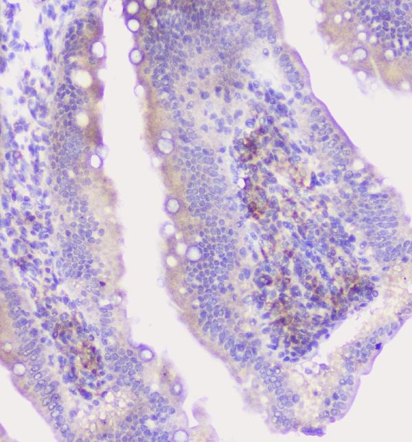 IHC analysis of CFP using anti-CFP antibody (A00852-2).