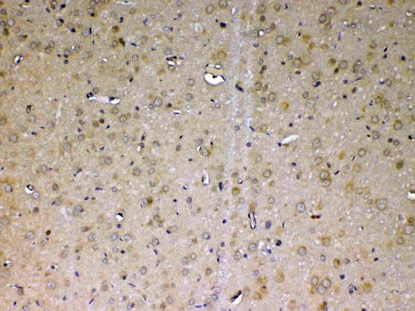 IHC analysis of ADA using anti-ADA antibody (A00866-1).