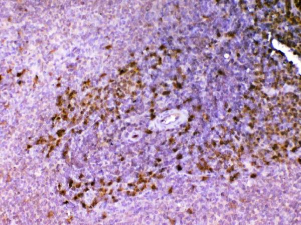 IHC analysis of ADA using anti-ADA antibody (A00866-2).