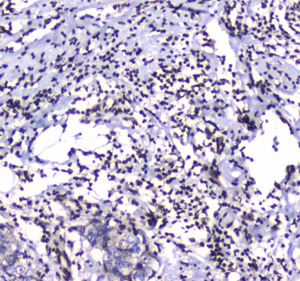 IHC analysis of GFI1 using anti-GFI1 antibody (A00888-1).