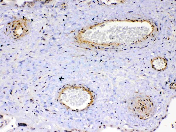 IHC analysis of VEGF Receptor 2 using anti-VEGF Receptor 2 antibody (A00901-2). VEGF Receptor 2 was detected in paraffin-embedded section of human placenta tissue. Heat mediated antigen retrieval was performed in citrate buffer (pH6, epitope retrieval solution) for 20 mins. The tissue section was blocked with 10% goat serum. The tissue section was then incubated with 1ug/ml rabbit anti-VEGF Receptor 2 Antibody (A00901-2) overnight at 4 Biotinylated goat anti-rabbit IgG was used as secondary antibody and incubated for 30 minutes at 37 The tissue section was developed using Strepavidin-Biotin-Complex (SABC)(Catalog # SA1022) with DAB as the chromogen.