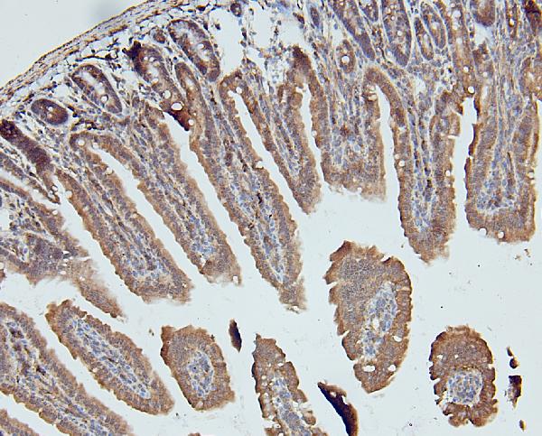 IHC analysis of DDR1 using anti-DDR1 antibody (A00905). DDR1 was detected in paraffin-embedded section of mouse intestine tissues. Heat mediated antigen retrieval was performed in citrate buffer (pH6, epitope retrieval solution) for 20 mins. The tissue section was blocked with 10% goat serum. The tissue section was then incubated with 1μg/ml rabbit anti-DDR1 Antibody (A00905) overnight at 4°C. Biotinylated goat anti-rabbit IgG was used as secondary antibody and incubated for 30 minutes at 37°C. The tissue section was developed using Strepavidin-Biotin-Complex (SABC)(Catalog # SA1022) with DAB as the chromogen.