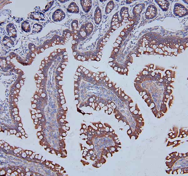 IHC analysis of DDR1 using anti-DDR1 antibody (A00905). DDR1 was detected in paraffin-embedded section of rat intestine tissues. Heat mediated antigen retrieval was performed in citrate buffer (pH6, epitope retrieval solution) for 20 mins. The tissue section was blocked with 10% goat serum. The tissue section was then incubated with 1μg/ml rabbit anti-DDR1 Antibody (A00905) overnight at 4°C. Biotinylated goat anti-rabbit IgG was used as secondary antibody and incubated for 30 minutes at 37°C. The tissue section was developed using Strepavidin-Biotin-Complex (SABC)(Catalog # SA1022) with DAB as the chromogen.