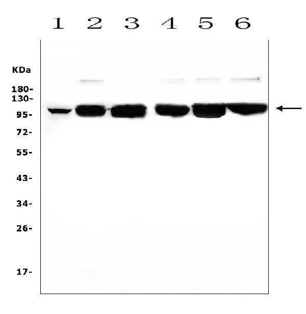 Western blot analysis of DDR1 using anti-DDR1 antibody (A00905). Electrophoresis was performed on a 5-20% SDS-PAGE gel at 70V (Stacking gel) / 90V (Resolving gel) for 2-3 hours. The sample well of each lane was loaded with 50ug of sample under reducing conditions. Lane 1: human placenta tissue lysates, Lane 2: human A549 whole cell lysates, Lane 3: human K562 whole cell lysates, Lane 4: human HepG2 whole cell lysates, Lane 5: human PC-3 whole cell lysates, Lane 6: human THP-1 whole cell lysates. After Electrophoresis, proteins were transferred to a Nitrocellulose membrane at 150mA for 50-90 minutes. Blocked the membrane with 5% Non-fat Milk/ TBS for 1.5 hour at RT. The membrane was incubated with rabbit anti-DDR1 antigen affinity purified polyclonal antibody (Catalog # A00905) at 0.5 μg/mL overnight at 4°C, then washed with TBS-0.1%Tween 3 times with 5 minutes each and probed with a goat anti-rabbit IgG-HRP secondary antibody at a dilution of 1:10000 for 1.5 hour at RT. The signal is developed using an Enhanced Chemiluminescent detection (ECL) kit (Catalog # EK1002) with Tanon 5200 system. A specific band was detected for DDR1 at approximately 101KD. The expected band size for DDR1 is at 101KD.