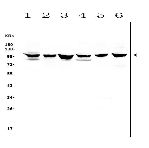 Western blot analysis of DDR1 using anti-DDR1 antibody (A00905). Electrophoresis was performed on a 5-20% SDS-PAGE gel at 70V (Stacking gel) / 90V (Resolving gel) for 2-3 hours. The sample well of each lane was loaded with 50ug of sample under reducing conditions. Lane 1: rat brain tissue lysates, Lane 2: rat lung tissue lysates, Lane 3: rat testicular tissue lysates, Lane 4: mouse brain tissue lysates, Lane 5: mouse lung tissue lysates, Lane 6: mouse testicular tissue lysates. After Electrophoresis, proteins were transferred to a Nitrocellulose membrane at 150mA for 50-90 minutes. Blocked the membrane with 5% Non-fat Milk/ TBS for 1.5 hour at RT. The membrane was incubated with rabbit anti-DDR1 antigen affinity purified polyclonal antibody (Catalog # A00905) at 0.5 μg/mL overnight at 4°C, then washed with TBS-0.1%Tween 3 times with 5 minutes each and probed with a goat anti-rabbit IgG-HRP secondary antibody at a dilution of 1:10000 for 1.5 hour at RT. The signal is developed using an Enhanced Chemiluminescent detection (ECL) kit (Catalog # EK1002) with Tanon 5200 system. A specific band was detected for DDR1 at approximately 101KD. The expected band size for DDR1 is at 101KD.