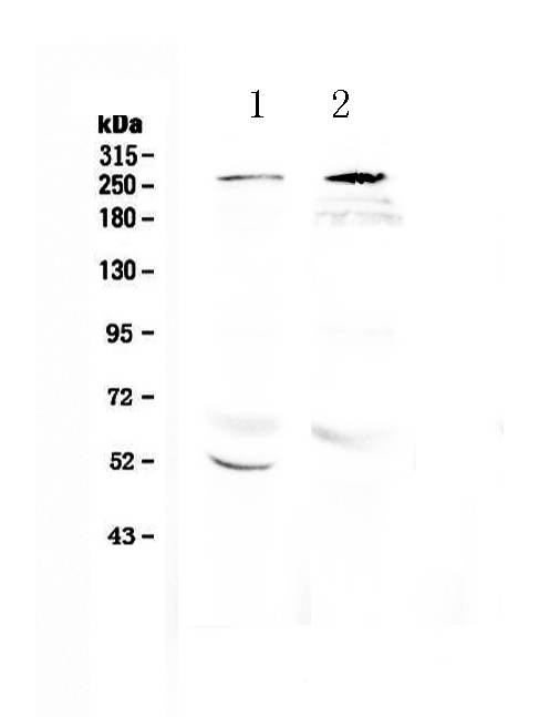 Western blot analysis of RanBP2 using anti-RanBP2 antibody (A00981).