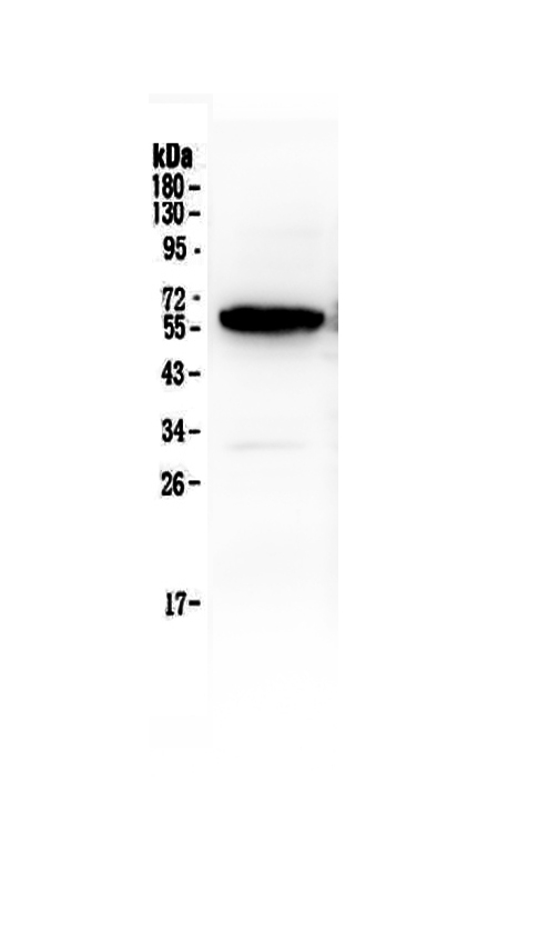 Western blot analysis of Syndecan-1/SDC1 using anti-Syndecan-1/SDC1 antibody (A00991-1).