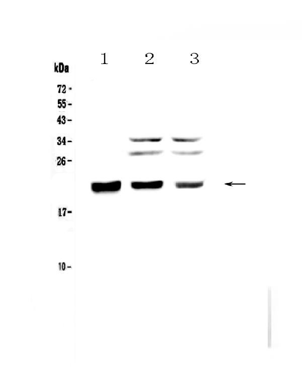 Western blot analysis of CBFb using anti-CBFb antibody (A01007-1).