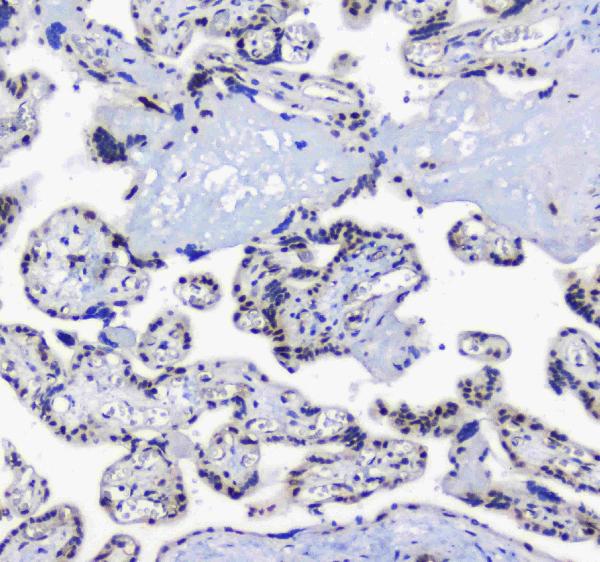 IHC analysis of splicing factor 1 using anti-splicing factor 1 antibody (A01009).