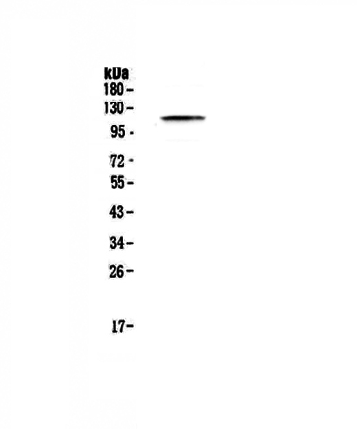 Western blot analysis of PMS2 using anti-PMS2 antibody (A01028).