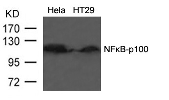 Anti-NFkB-p100 (Ab-866) NFKB2 Antibody