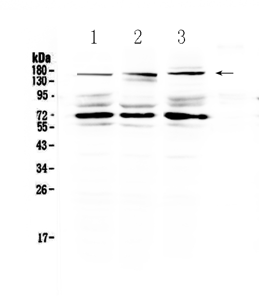 Western blot analysis of IL17RA using anti-IL17RA antibody (A01311-2).
