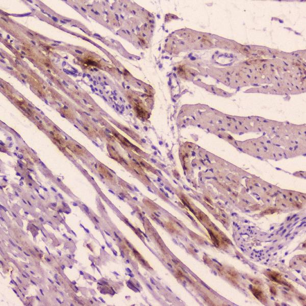 IHC analysis of ANP using anti-ANP antibody (A01318). ANP was detected in paraffin-embedded section of rat cardiac muscle tissue. Heat mediated antigen retrieval was performed in citrate buffer (pH6, epitope retrieval solution) for 20 mins. The tissue section was blocked with 10% goat serum. The tissue section was then incubated with 2μg/ml rabbit anti-ANP Antibody (A01318) overnight at 4℃. Biotinylated goat anti-rabbit IgG was used as secondary antibody and incubated for 30 minutes at 37℃. The tissue section was developed using Strepavidin-Biotin-Complex (SABC)(Catalog # SA1022) with DAB as the chromogen.