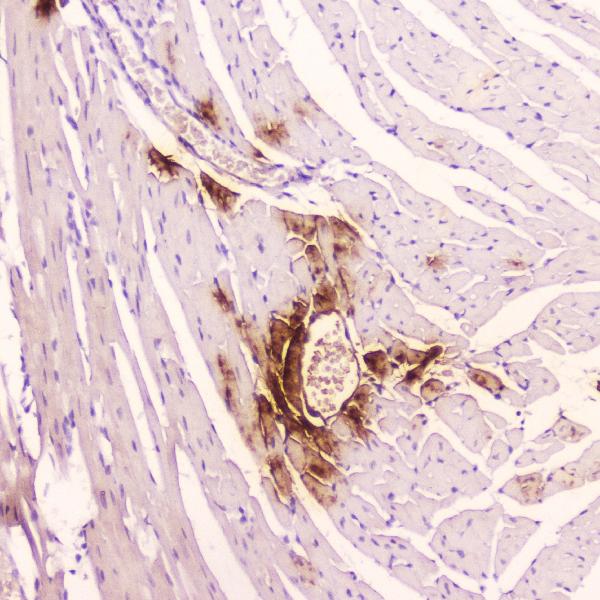 IHC analysis of ANP using anti-ANP antibody (A01318). ANP was detected in paraffin-embedded section of mouse cardiac muscle tissue. Heat mediated antigen retrieval was performed in citrate buffer (pH6, epitope retrieval solution) for 20 mins. The tissue section was blocked with 10% goat serum. The tissue section was then incubated with 2μg/ml rabbit anti-ANP Antibody (A01318) overnight at 4℃. Biotinylated goat anti-rabbit IgG was used as secondary antibody and incubated for 30 minutes at 37℃. The tissue section was developed using Strepavidin-Biotin-Complex (SABC)(Catalog # SA1022) with DAB as the chromogen.