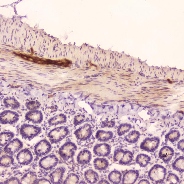 IHC analysis of ANP using anti-ANP antibody (A01318). ANP was detected in paraffin-embedded section of rat small intestine tissue. Heat mediated antigen retrieval was performed in citrate buffer (pH6, epitope retrieval solution) for 20 mins. The tissue section was blocked with 10% goat serum. The tissue section was then incubated with 2μg/ml rabbit anti-ANP Antibody (A01318) overnight at 4°C. Biotinylated goat anti-rabbit IgG was used as secondary antibody and incubated for 30 minutes at 37°C. The tissue section was developed using Strepavidin-Biotin-Complex (SABC)(Catalog # SA1022) with DAB as the chromogen.