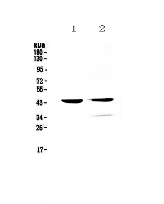 Western blot analysis of Cathepsin D using anti-Cathepsin D antibody (A01361).