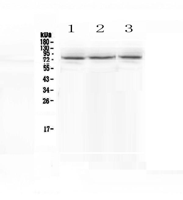 Western blot analysis of SCNN1A using anti-SCNN1A antibody (A01413-1).