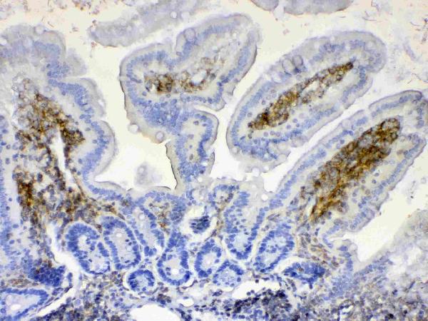 IHC analysis of Lyn using anti-Lyn antibody (A01424-2).