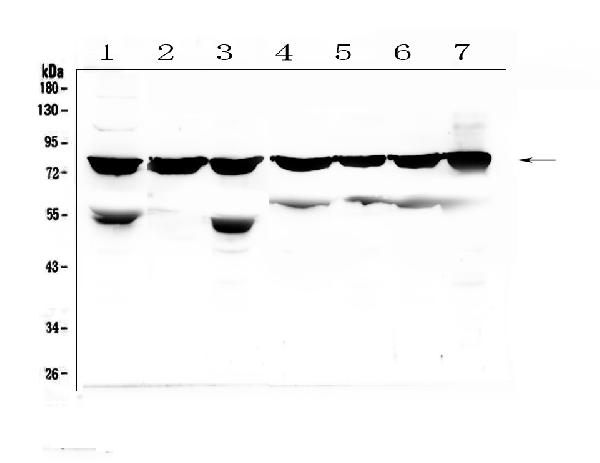 Western blot analysis of PKC beta 1 using anti-PKC beta 1 antibody (A01940). Electrophoresis was performed on a 5-20% SDS-PAGE gel at 70V (Stacking gel) / 90V (Resolving gel) for 2-3 hours. The sample well of each lane was loaded with 50ug of sample under reducing conditions. Lane 1: human K562 whole cell lysate, Lane 2: human THP-1 whole cell lysate, Lane 3: human HEK293 whole cell lysate, Lane 4: human Jurkat whole cell lysate, Lane 5: human Raji whole cell lysate, Lane 6: human HL-60 whole cell lysate, Lane 7: human A549 whole cell lysate. After Electrophoresis, proteins were transferred to a Nitrocellulose membrane at 150mA for 50-90 minutes. Blocked the membrane with 5% Non-fat Milk/ TBS for 1.5 hour at RT. The membrane was incubated with rabbit anti-PKC beta 1 antigen affinity purified polyclonal antibody (Catalog # A01940) at 0.5 μg/mL overnight at 4°C, then washed with TBS-0.1%Tween 3 times with 5 minutes each and probed with a goat anti-rabbit IgG-HRP secondary antibody at a dilution of 1:10000 for 1.5 hour at RT. The signal is developed using an Enhanced Chemiluminescent detection (ECL) kit (Catalog # EK1002) with Tanon 5200 system. A specific band was detected for PKC beta 1 at approximately 77KD. The expected band size for PKC beta 1 is at 77KD.