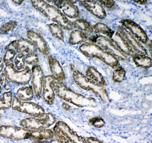 IHC analysis of Glycerol kinase using anti-Glycerol kinase antibody (A02884-1).