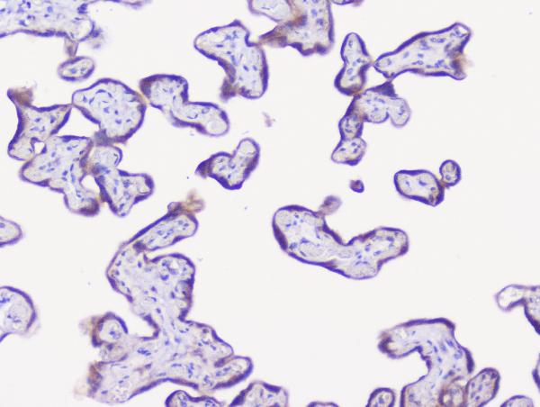 IHC analysis of NSE using anti-NSE antibody (A02930). NSE was detected in paraffin-embedded section of human placenta tissue. Heat mediated antigen retrieval was performed in citrate buffer (pH6, epitope retrieval solution) for 20 mins. The tissue section was blocked with 10% goat serum. The tissue section was then incubated with 1μg/ml rabbit anti-NSE Antibody (A02930) overnight at 4°C. Biotinylated goat anti-rabbit IgG was used as secondary antibody and incubated for 30 minutes at 37°C. The tissue section was developed using Strepavidin-Biotin-Complex (SABC)(Catalog # SA1022) with DAB as the chromogen.