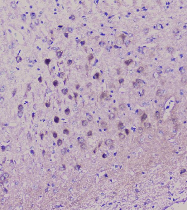 IHC analysis of NSE using anti-NSE antibody (A02930). NSE was detected in paraffin-embedded section of rat brain tissue. Heat mediated antigen retrieval was performed in citrate buffer (pH6, epitope retrieval solution) for 20 mins. The tissue section was blocked with 10% goat serum. The tissue section was then incubated with 1μg/ml rabbit anti-NSE Antibody (A02930) overnight at 4°C. Biotinylated goat anti-rabbit IgG was used as secondary antibody and incubated for 30 minutes at 37°C. The tissue section was developed using Strepavidin-Biotin-Complex (SABC)(Catalog # SA1022) with DAB as the chromogen.