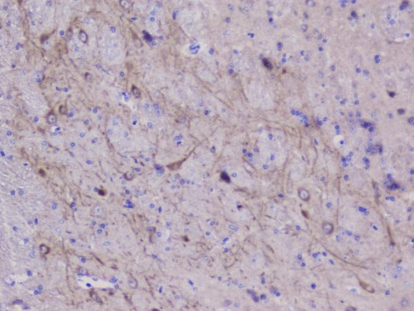 IHC analysis of NSE using anti-NSE antibody (A02930). NSE was detected in paraffin-embedded section of mouse brain tissue. Heat mediated antigen retrieval was performed in citrate buffer (pH6, epitope retrieval solution) for 20 mins. The tissue section was blocked with 10% goat serum. The tissue section was then incubated with 1μg/ml rabbit anti-NSE Antibody (A02930) overnight at 4°C. Biotinylated goat anti-rabbit IgG was used as secondary antibody and incubated for 30 minutes at 37°C. The tissue section was developed using Strepavidin-Biotin-Complex (SABC)(Catalog # SA1022) with DAB as the chromogen.