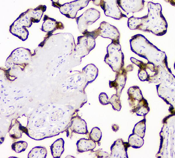 IHC analysis of PLAT using anti-PLAT antibody (A02965-1). PLAT was detected in paraffin-embedded section of human placenta tissue. Heat mediated antigen retrieval was performed in citrate buffer (pH6, epitope retrieval solution) for 20 mins. The tissue section was blocked with 10% goat serum. The tissue section was then incubated with 1μg/ml rabbit anti-PLAT Antibody (A02965-1) overnight at 4°C. Biotinylated goat anti-rabbit IgG was used as secondary antibody and incubated for 30 minutes at 37°C. The tissue section was developed using Strepavidin-Biotin-Complex (SABC)(Catalog # SA1022) with DAB as the chromogen.