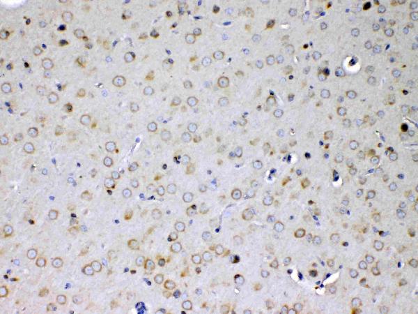 IHC analysis of IL15RA using anti-IL15RA antibody (A03016-1). IL15RA was detected in paraffin-embedded section of mouse brain tissue. Heat mediated antigen retrieval was performed in citrate buffer (pH6, epitope retrieval solution) for 20 mins. The tissue section was blocked with 10% goat serum. The tissue section was then incubated with 1ug/ml rabbit anti-IL15RA Antibody (A03016-1) overnight at 4 Biotinylated goat anti-rabbit IgG was used as secondary antibody and incubated for 30 minutes at 37 The tissue section was developed using Strepavidin-Biotin-Complex (SABC)(Catalog # SA1022) with DAB as the chromogen.