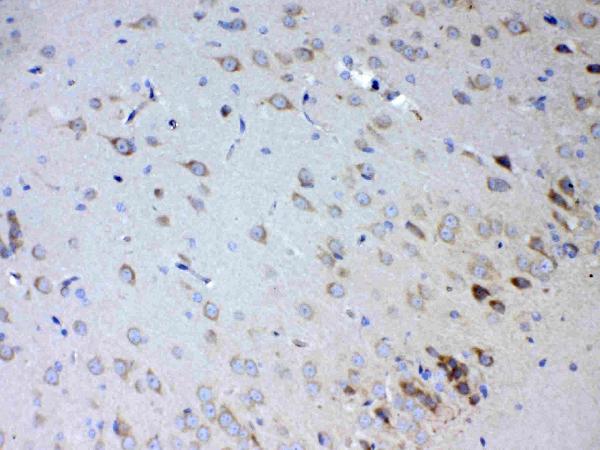 IHC analysis of IL15RA using anti-IL15RA antibody (A03016-1). IL15RA was detected in paraffin-embedded section of rat brain tissue. Heat mediated antigen retrieval was performed in citrate buffer (pH6, epitope retrieval solution) for 20 mins. The tissue section was blocked with 10% goat serum. The tissue section was then incubated with 1ug/ml rabbit anti-IL15RA Antibody (A03016-1) overnight at 4 Biotinylated goat anti-rabbit IgG was used as secondary antibody and incubated for 30 minutes at 37 The tissue section was developed using Strepavidin-Biotin-Complex (SABC)(Catalog # SA1022) with DAB as the chromogen.