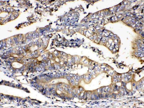 IHC analysis of Calpain 2 using anti-Calpain 2 antibody (A03492).