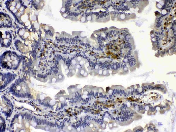 IHC analysis of Calpain 2 using anti-Calpain 2 antibody (A03492). Calpain 2 was detected in paraffin-embedded section of rat small intestine tissue. Heat mediated antigen retrieval was performed in citrate buffer (pH6, epitope retrieval solution) for 20 mins. The tissue section was blocked with 10% goat serum. The tissue section was then incubated with 1μg/ml rabbit anti-Calpain 2 Antibody (A03492) overnight at 4°C. Biotinylated goat anti-rabbit IgG was used as secondary antibody and incubated for 30 minutes at 37°C. The tissue section was developed using Strepavidin-Biotin-Complex (SABC)(Catalog # SA1022) with DAB as the chromogen.