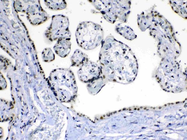 IHC analysis of MED15 using anti-MED15 antibody (A03568-1). MED15 was detected in paraffin-embedded section of human placenta tissue. Heat mediated antigen retrieval was performed in citrate buffer (pH6, epitope retrieval solution) for 20 mins. The tissue section was blocked with 10% goat serum. The tissue section was then incubated with 1ug/ml rabbit anti-MED15 Antibody (A03568-1) overnight at 4 Biotinylated goat anti-rabbit IgG was used as secondary antibody and incubated for 30 minutes at 37 The tissue section was developed using Strepavidin-Biotin-Complex (SABC)(Catalog # SA1022) with DAB as the chromogen.