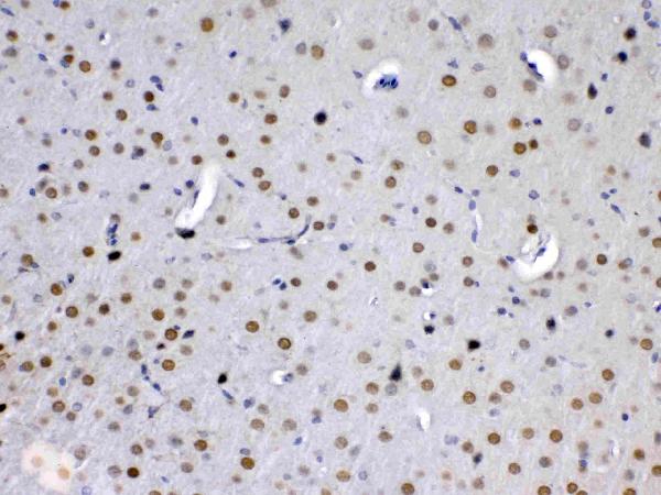 IHC analysis of MED15 using anti-MED15 antibody (A03568-1). MED15 was detected in paraffin-embedded section of mouse brain tissue. Heat mediated antigen retrieval was performed in citrate buffer (pH6, epitope retrieval solution) for 20 mins. The tissue section was blocked with 10% goat serum. The tissue section was then incubated with 1ug/ml rabbit anti-MED15 Antibody (A03568-1) overnight at 4 Biotinylated goat anti-rabbit IgG was used as secondary antibody and incubated for 30 minutes at 37 The tissue section was developed using Strepavidin-Biotin-Complex (SABC)(Catalog # SA1022) with DAB as the chromogen.