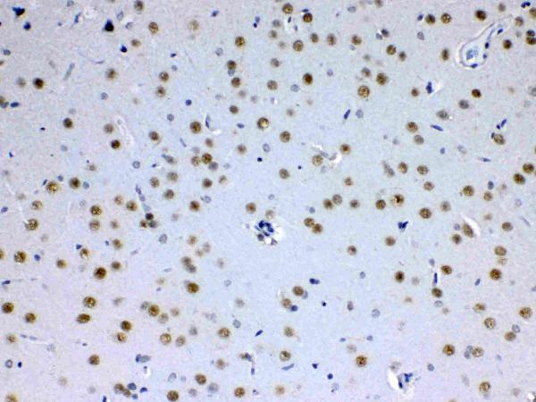 IHC analysis of MED15 using anti-MED15 antibody (A03568-1). MED15 was detected in paraffin-embedded section of rat brain tissue. Heat mediated antigen retrieval was performed in citrate buffer (pH6, epitope retrieval solution) for 20 mins. The tissue section was blocked with 10% goat serum. The tissue section was then incubated with 1ug/ml rabbit anti-MED15 Antibody (A03568-1) overnight at 4 Biotinylated goat anti-rabbit IgG was used as secondary antibody and incubated for 30 minutes at 37 The tissue section was developed using Strepavidin-Biotin-Complex (SABC)(Catalog # SA1022) with DAB as the chromogen.