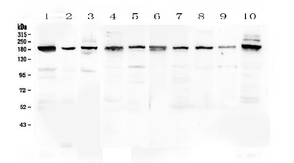 Western blot analysis of PCDH15 using anti-PCDH15 antibody (A03591-1).