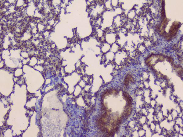 IHC analysis of SLC34A2 using anti-SLC34A2 antibody (A03957-1). SLC34A2 was detected in paraffin-embedded section of mouse lung tissue. Heat mediated antigen retrieval was performed in citrate buffer (pH6, epitope retrieval solution) for 20 mins. The tissue section was blocked with 10% goat serum. The tissue section was then incubated with 1μg/ml rabbit anti-SLC34A2 Antibody (A03957-1) overnight at 4°C. Biotinylated goat anti-rabbit IgG was used as secondary antibody and incubated for 30 minutes at 37°C. The tissue section was developed using Strepavidin-Biotin-Complex (SABC)(Catalog # SA1022) with DAB as the chromogen.