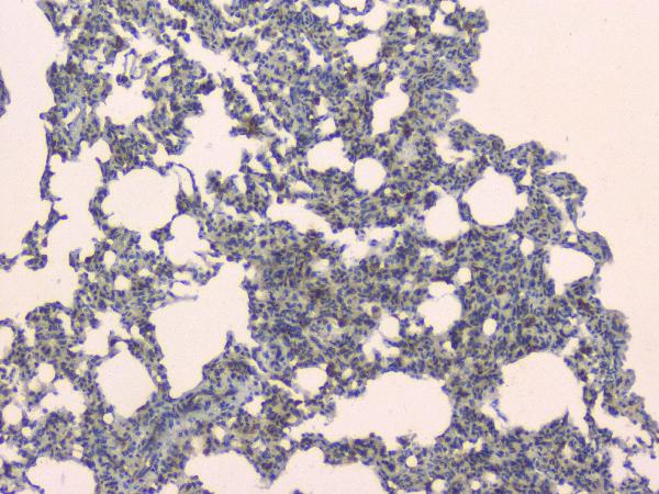 IHC analysis of SLC34A2 using anti-SLC34A2 antibody (A03957-1). SLC34A2 was detected in paraffin-embedded section of rat lung tissue. Heat mediated antigen retrieval was performed in citrate buffer (pH6, epitope retrieval solution) for 20 mins. The tissue section was blocked with 10% goat serum. The tissue section was then incubated with 1μg/ml rabbit anti-SLC34A2 Antibody (A03957-1) overnight at 4°C. Biotinylated goat anti-rabbit IgG was used as secondary antibody and incubated for 30 minutes at 37°C. The tissue section was developed using Strepavidin-Biotin-Complex (SABC)(Catalog # SA1022) with DAB as the chromogen.