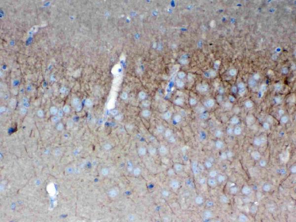 IHC analysis of SAP102 using anti-SAP102 antibody (A04152-1).