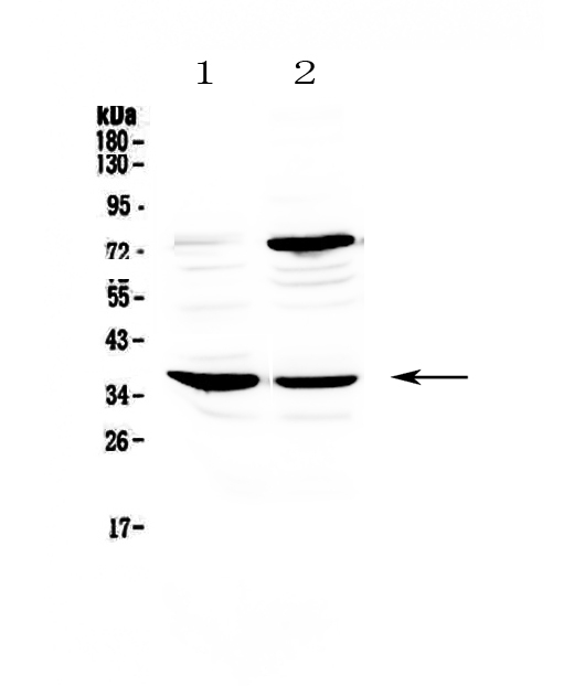 Western blot analysis of CD23 using anti-CD23 antibody (A04237).