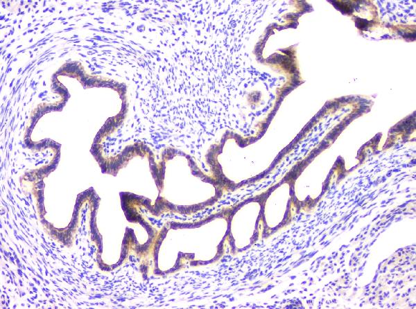 IHC analysis of RAB11B using anti-RAB11B antibody (A04526-1). RAB11B was detected in paraffin-embedded section of mouse ovary tissue. Heat mediated antigen retrieval was performed in citrate buffer (pH6, epitope retrieval solution) for 20 mins. The tissue section was blocked with 10% goat serum. The tissue section was then incubated with 1μg/ml rabbit anti-RAB11B Antibody (A04526-1) overnight at 4°C. Biotinylated goat anti-rabbit IgG was used as secondary antibody and incubated for 30 minutes at 37°C. The tissue section was developed using Strepavidin-Biotin-Complex (SABC)(Catalog # SA1022) with DAB as the chromogen.