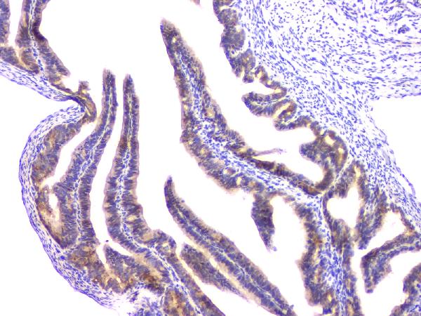 IHC analysis of RAB11B using anti-RAB11B antibody (A04526-1). RAB11B was detected in paraffin-embedded section of rat ovary tissue. Heat mediated antigen retrieval was performed in citrate buffer (pH6, epitope retrieval solution) for 20 mins. The tissue section was blocked with 10% goat serum. The tissue section was then incubated with 1μg/ml rabbit anti-RAB11B Antibody (A04526-1) overnight at 4°C. Biotinylated goat anti-rabbit IgG was used as secondary antibody and incubated for 30 minutes at 37°C. The tissue section was developed using Strepavidin-Biotin-Complex (SABC)(Catalog # SA1022) with DAB as the chromogen.