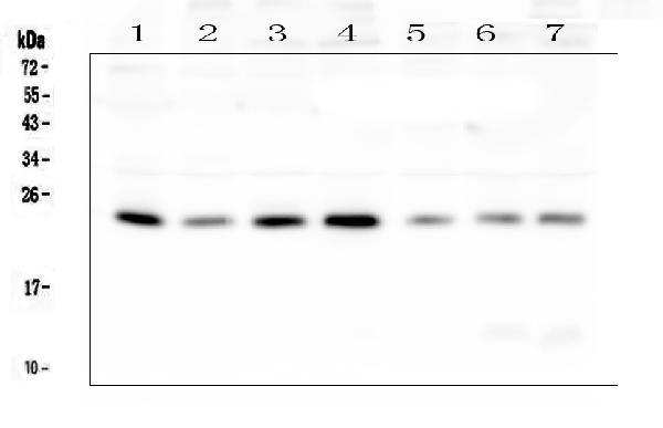 Western blot analysis of RAB11B using anti-RAB11B antibody (A04526-1). Electrophoresis was performed on a 5-20% SDS-PAGE gel at 70V (Stacking gel) / 90V (Resolving gel) for 2-3 hours. The sample well of each lane was loaded with 50ug of sample under reducing conditions. Lane 1: human placenta tissue lysates, Lane 2: human A549 whole cell lysates, Lane 3: human U-87MG whole cell lysates, Lane 4: human PC-3 whole cell lysates, Lane 5: human Hela whole cell lysates, Lane 6: human Caco-2 whole cell lysates, Lane 7: human HL-60 whole cell lysates. After Electrophoresis, proteins were transferred to a Nitrocellulose membrane at 150mA for 50-90 minutes. Blocked the membrane with 5% Non-fat Milk/ TBS for 1.5 hour at RT. The membrane was incubated with rabbit anti-RAB11B antigen affinity purified polyclonal antibody (Catalog # A04526-1) at 0.5 μg/mL overnight at 4°C, then washed with TBS-0.1%Tween 3 times with 5 minutes each and probed with a goat anti-rabbit IgG-HRP secondary antibody at a dilution of 1:10000 for 1.5 hour at RT. The signal is developed using an Enhanced Chemiluminescent detection (ECL) kit (Catalog # EK1002) with Tanon 5200 system. A specific band was detected for RAB11B at approximately 24KD. The expected band size for RAB11B is at 24KD.