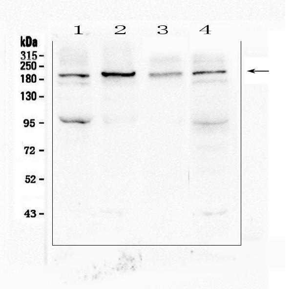 Western blot analysis of SI using anti-SI antibody (A04542-1).