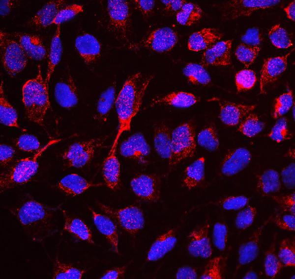 Anti-RBMS3 Antibody Picoband™ | Bosterbio